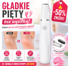 🦶✨ -50% 🔥 Gładkie pięty bez wysiłku! 👣 Elektryczny pilnik do stóp – efekt już po pierwszym użyciu!